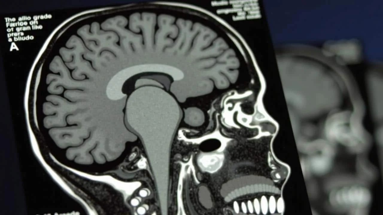 MRI scans reveal the shocking reason teenager brain development makes them ignore parents